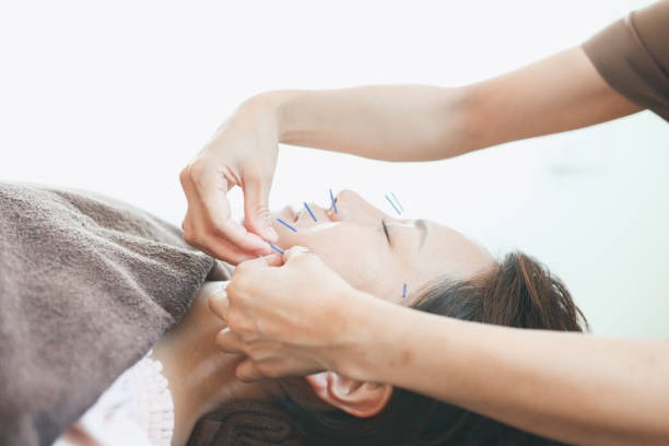 美容鍼の効果とは？持続させるためのコツや注意点など徹底解説！
